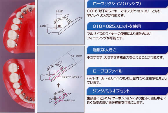 KSL System Lingual Bracket Tube